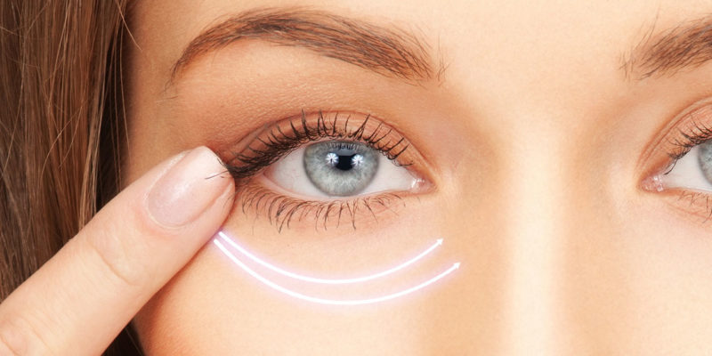 Phẫu thuật thẩm mỹ mắt và những thông tin hữu ích cho phái đẹp